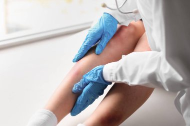 Kadın doktor klinikte yaralı bacağını muayene ediyor.