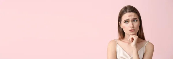 Портрет Грустной Молодой Женщины Проблемой Прыщей Розовом Фоне Пространством Текста — стоковое фото