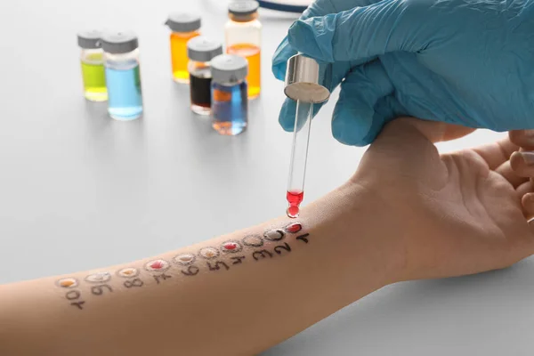 Doctor making allergy skin test on patient\'s hand in clinic, closeup