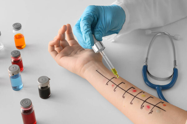 Doctor making allergy skin test on patient's hand in clinic, closeup