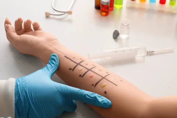 Doctor and marked patient\'s hand for allergy skin tests in clinic, closeup