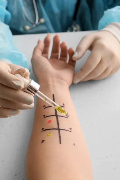 Doctor with dropper making allergy skin test on patient\'s hand in clinic, closeup