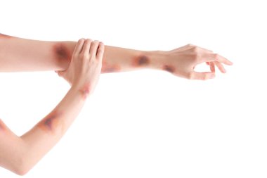 Beyaz arka planda çürük kadın elleri