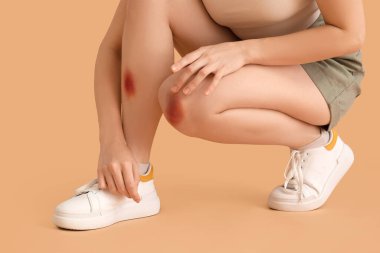 Bej arka planda çürük bacaklı genç bir kadın.