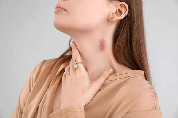 Young Woman Love Bite Her Neck Grey Background Closeup — Stock Photo, Image