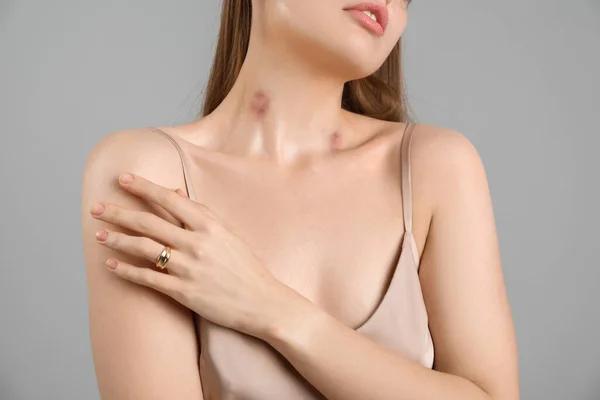 Beautiful Woman Love Bites Her Neck Grey Background Closeup — Stock Photo, Image