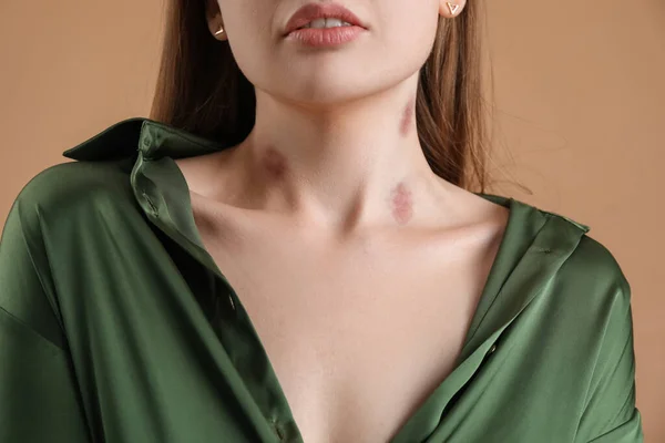 Young Woman Love Bites Her Neck Color Background Closeup — Stock Photo, Image