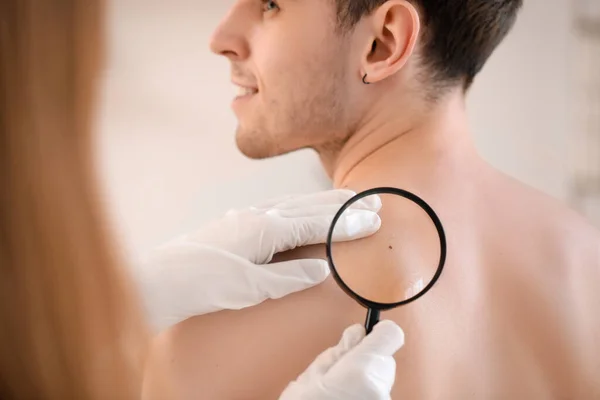 Dermatologista Examinando Toupeira Nas Costas Jovem Com Lupa Clínica Close — Fotografia de Stock