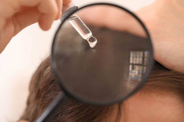 Young Man Using Serum Hair Growth Magnifier Closeup — Stock Photo, Image