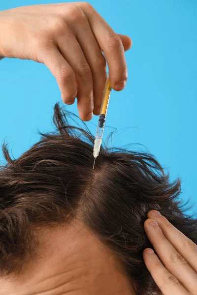 Młody Człowiek Problemami Wypadaniem Włosów Wstrzykiwanie Niebieskim Tle Zbliżenie — Zdjęcie stockowe