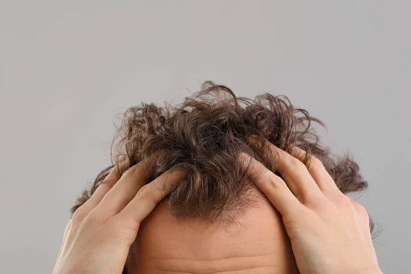 Молодий Чоловік Проблемою Випадіння Волосся Сірому Фоні Крупним Планом — стокове фото