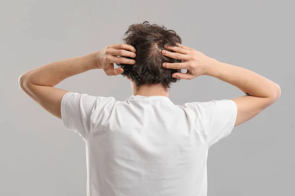 Молодий Чоловік Проблемою Випадіння Волосся Сірому Фоні Вид Ззаду — стокове фото