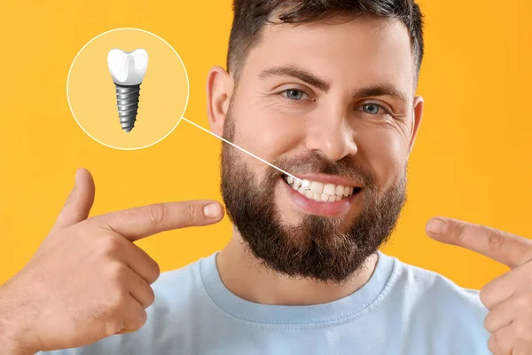 Young man with implanted teeth on yellow background