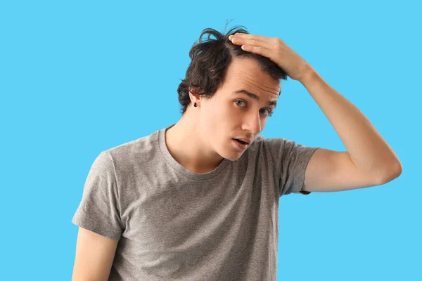 青の背景に脱毛の問題を持つ若い男 — ストック写真