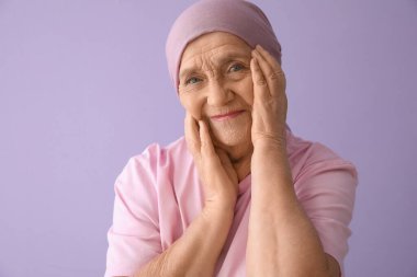 Leylak arka planında kemoterapiden sonra üst düzey kadın, yakın plan.