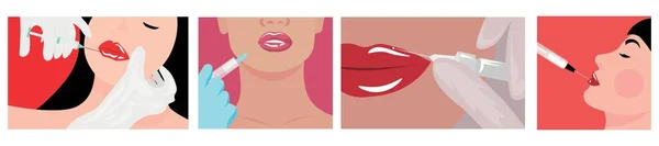 Set Von Schönen Jungen Frauen Erhalten Füllstoff Injektion Die Lippen — Stockvektor