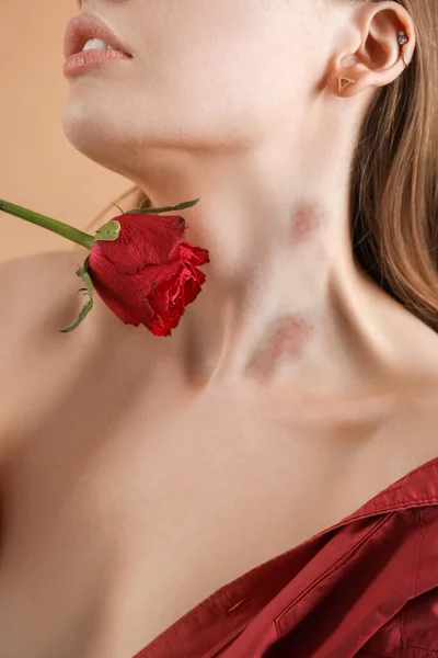 Mujer Con Mordeduras Amor Cuello Rosa Flor Sobre Fondo Color —  Fotos de Stock