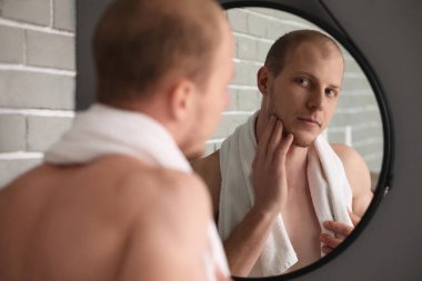 Yüzünde kıllar olan genç adam aynaya bakıyor.