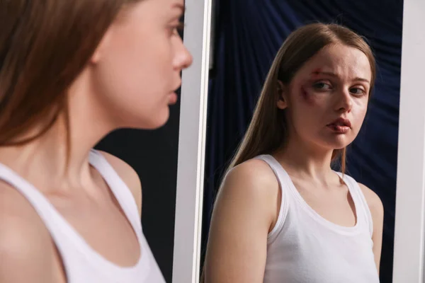 Blåslagen Ung Kvinna Nära Spegel Mörk Bakgrund Närbild Begreppet Våld — Stockfoto
