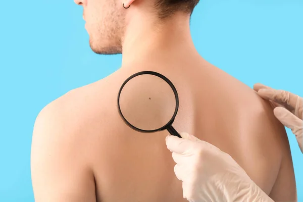Dermatolog Genç Adamın Sırtındaki Beni Mavi Arka Planda Büyüteçle Inceliyor — Stok fotoğraf