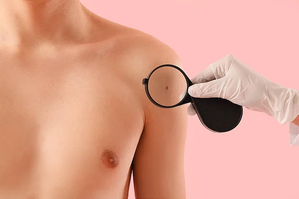 Dermatologist Examining Mole Young Man Shoulder Magnifier Pink Background Closeup — Stock Photo, Image