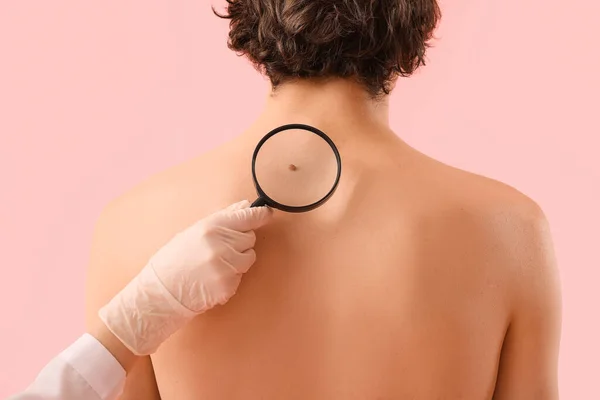 Dermatologist Examining Mole Young Man Back Magnifier Pink Background Closeup — Stock Photo, Image