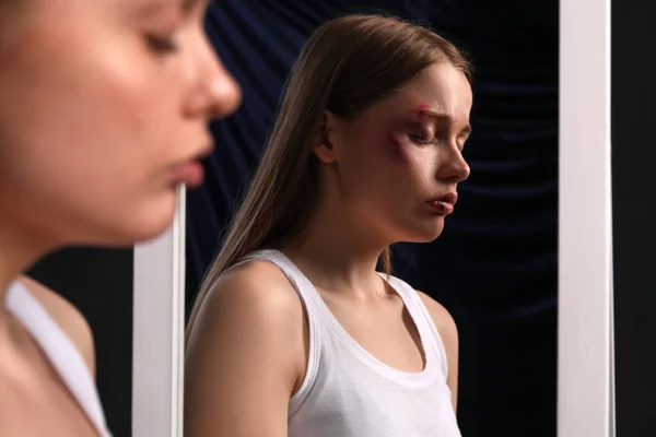 Blåslagen Ung Kvinna Nära Spegel Mörk Bakgrund Närbild Begreppet Våld — Stockfoto
