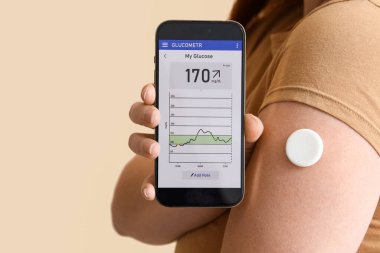 Glikoz sensörü olan bir kadın kan şekerini bej arka planda ölçmek için cep telefonu kullanıyor.