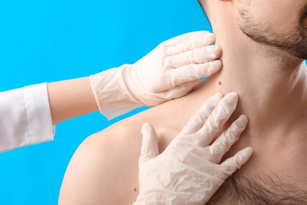 stock image Dermatologist examining mole of young man on blue background, closeup