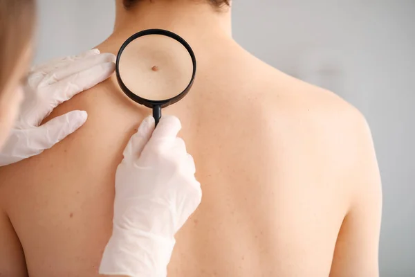 Dermatologist Examining Mole Young Man Back Magnifier Clinic Closeup — Stock Photo, Image