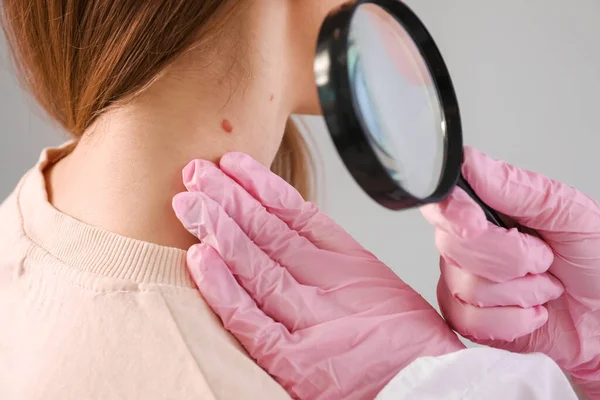 Dermatolog Undersöker Ung Kvinnas Födelsemärke Med Förstoringsglas Grå Bakgrund Närbild — Stockfoto