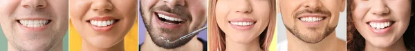 Collage Många Människor Med Friska Tänder Närbild — Stockfoto