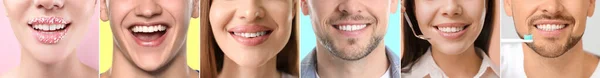 Колаж Багатьох Людей Здоровими Зубами Крупним Планом — стокове фото