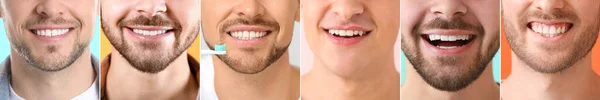 Κολάζ Πολλών Ανδρών Υγιή Δόντια Closeup — Φωτογραφία Αρχείου