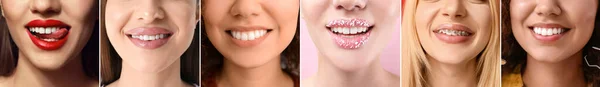 Colagem Muitas Mulheres Com Dentes Saudáveis Close — Fotografia de Stock