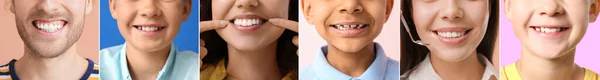 Kolaż Wielu Osób Zdrowymi Zębami Zbliżenie — Zdjęcie stockowe