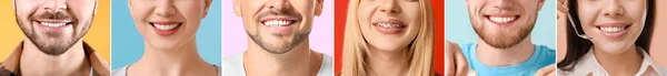 Koláž Mnoha Lidí Zdravými Zuby Detailní Záběr — Stock fotografie