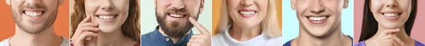 Collage Många Människor Med Friska Tänder Närbild — Stockfoto