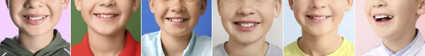 Colagem Muitas Crianças Com Dentes Saudáveis Close — Fotografia de Stock