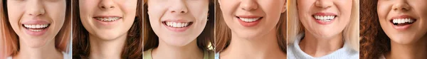 许多拥有健康牙齿的妇女的结合体 特写镜头 — 图库照片#