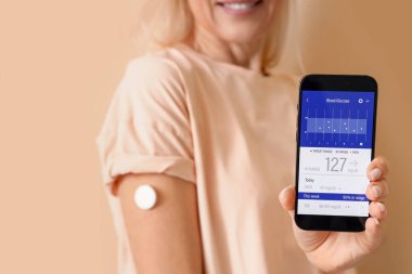 Bej arka planda kan şekeri seviyesini ölçen, cep telefonlu olgun diyabetik bir kadın.