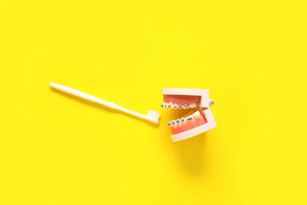 Modelo Mandíbula Con Frenos Dentales Cepillo Dientes Sobre Fondo Amarillo —  Fotos de Stock