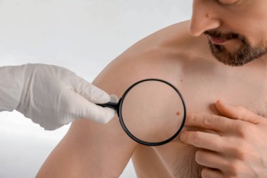 Beyaz arka planda benli genç adam, yakın plan.