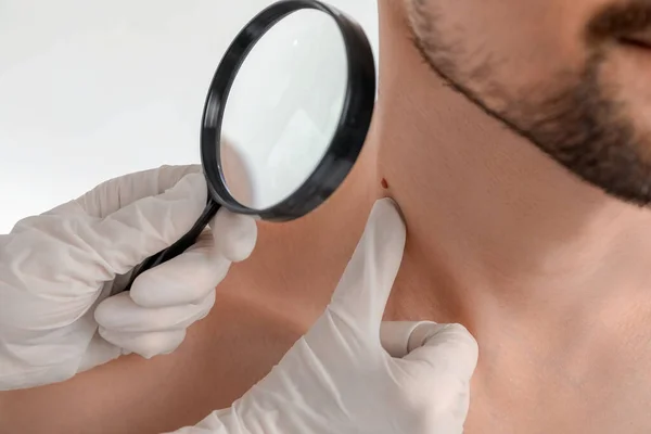 Dermatologo Esaminando Talpa Giovane Uomo Con Lente Ingrandimento Sfondo Bianco — Foto Stock