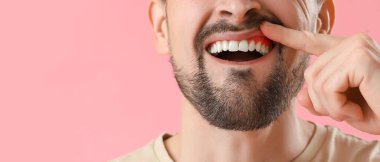 Pembe arka planda sakız iltihabı olan adam, yakın plan.