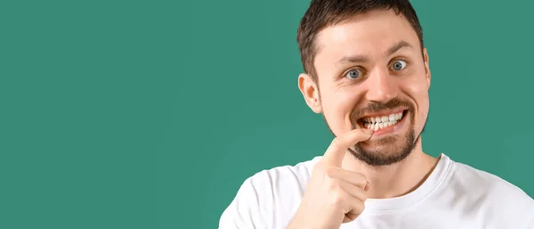 Mann Mit Zahnfleischentzündung Auf Grünem Hintergrund Mit Platz Für Text — Stockfoto