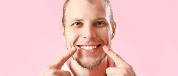 Mann Mit Zahnfleischentzündung Auf Rosa Hintergrund Nahaufnahme — Stockfoto