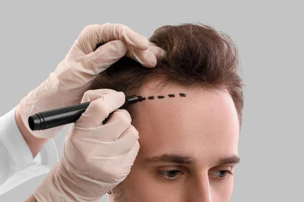 Doctor Marking Young Man Forehead Hair Loss Problem Grey Background — Stock Photo, Image