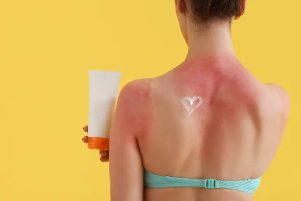 Αλλεργική Νεαρή Γυναίκα Ηλιοκαμένο Δέρμα Και Καρδιά Από Κρέμα Κίτρινο — Φωτογραφία Αρχείου