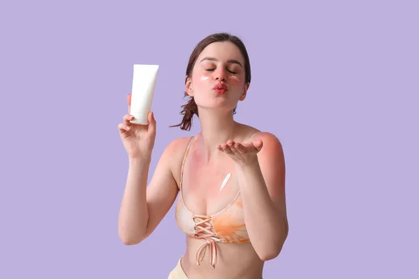 Allergische Jonge Vrouw Met Verbrand Huid Crème Blazen Kus Lila — Stockfoto